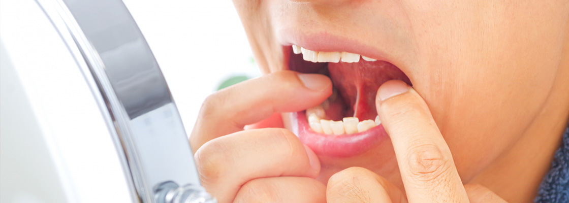 一般歯科について